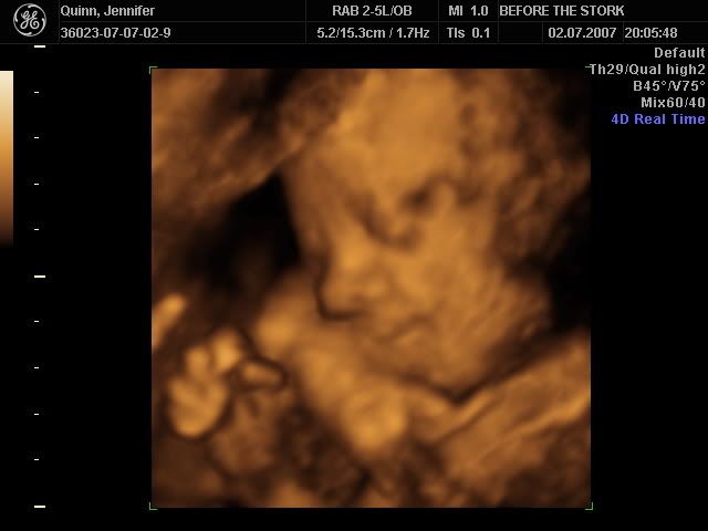 BABY_36.jpg
