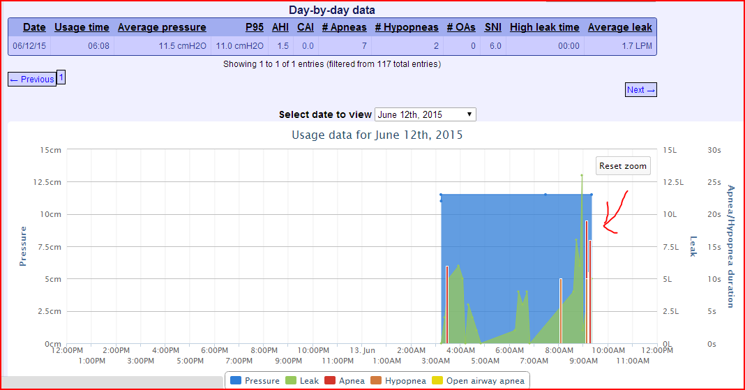 [Image: 6-12-2015%20CPAP%2011pt5_zpsxfci9k3f.png]